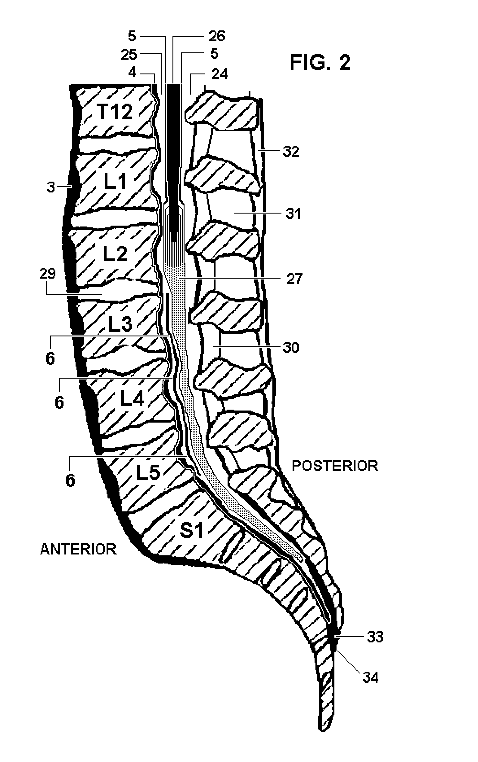 System and Methods for Diagnosis and Treatment of Discogenic Lower Back Pain