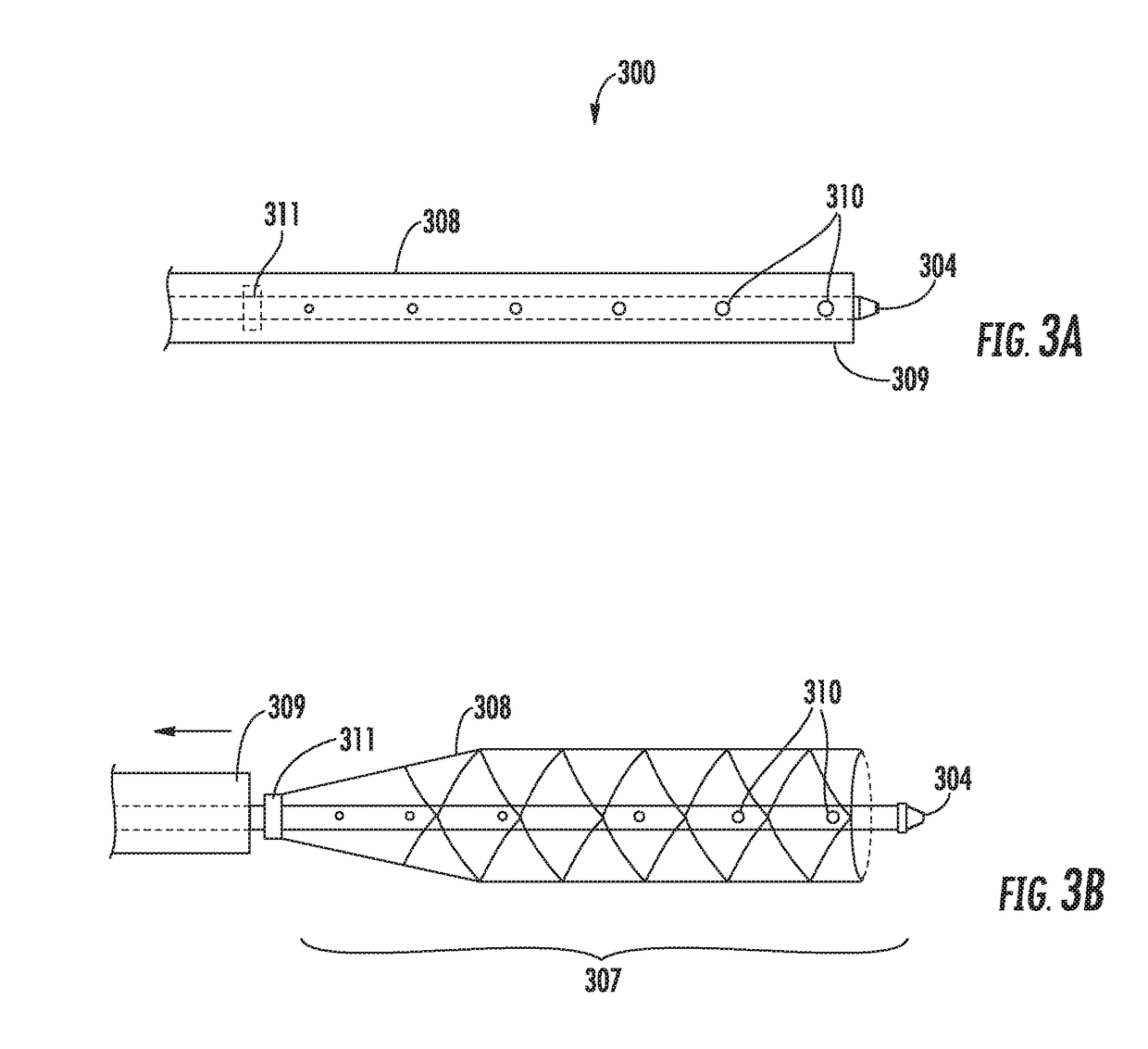 Apparatus and method for promoting angiogenesis in ischemic tissue