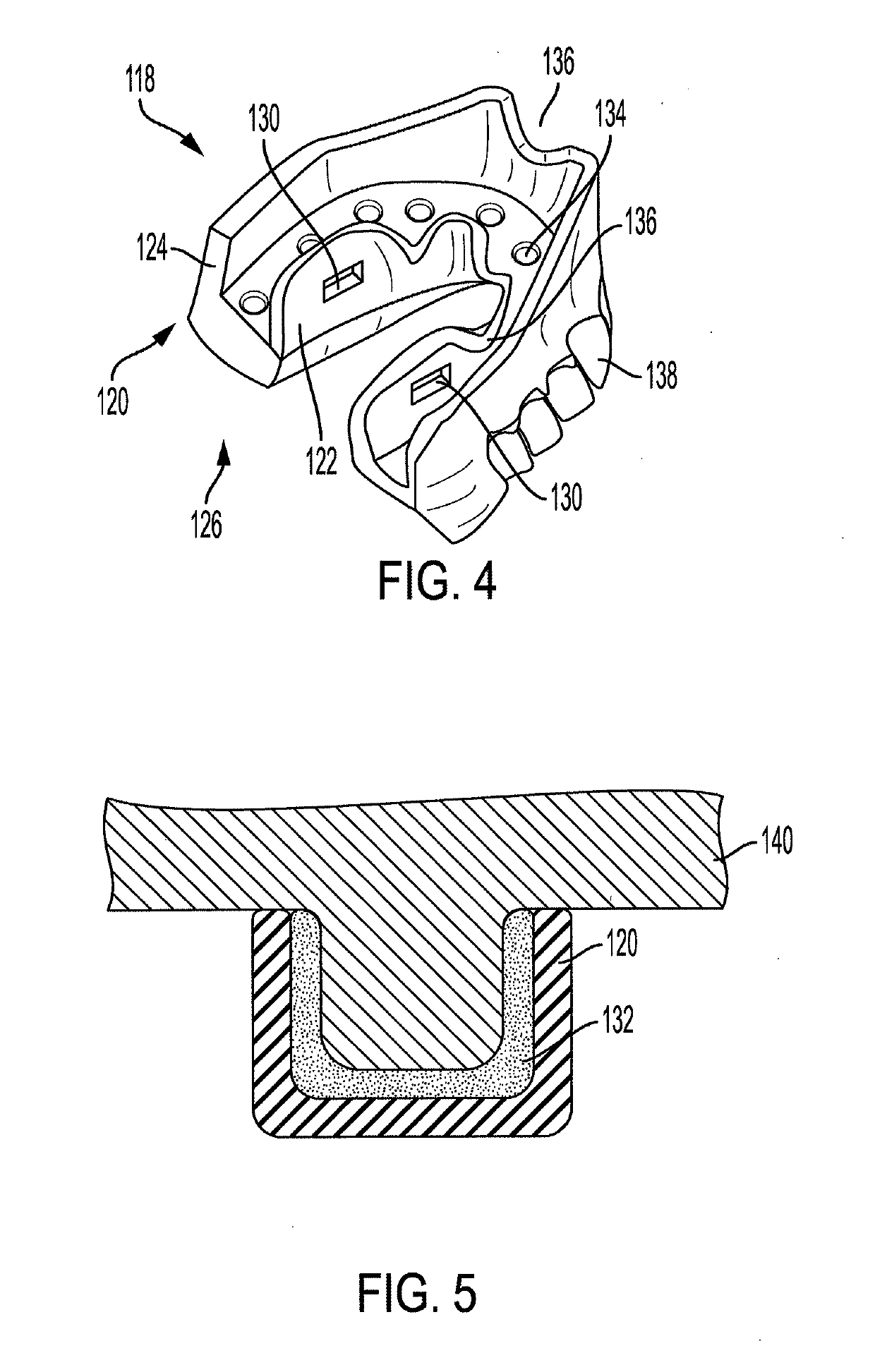 Edentulous specific support and aesthetic restorative appliance