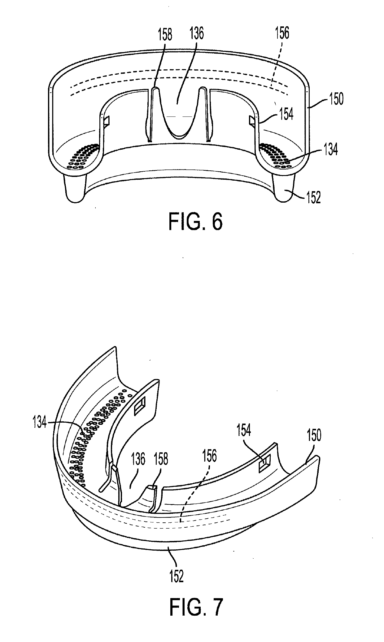 Edentulous specific support and aesthetic restorative appliance