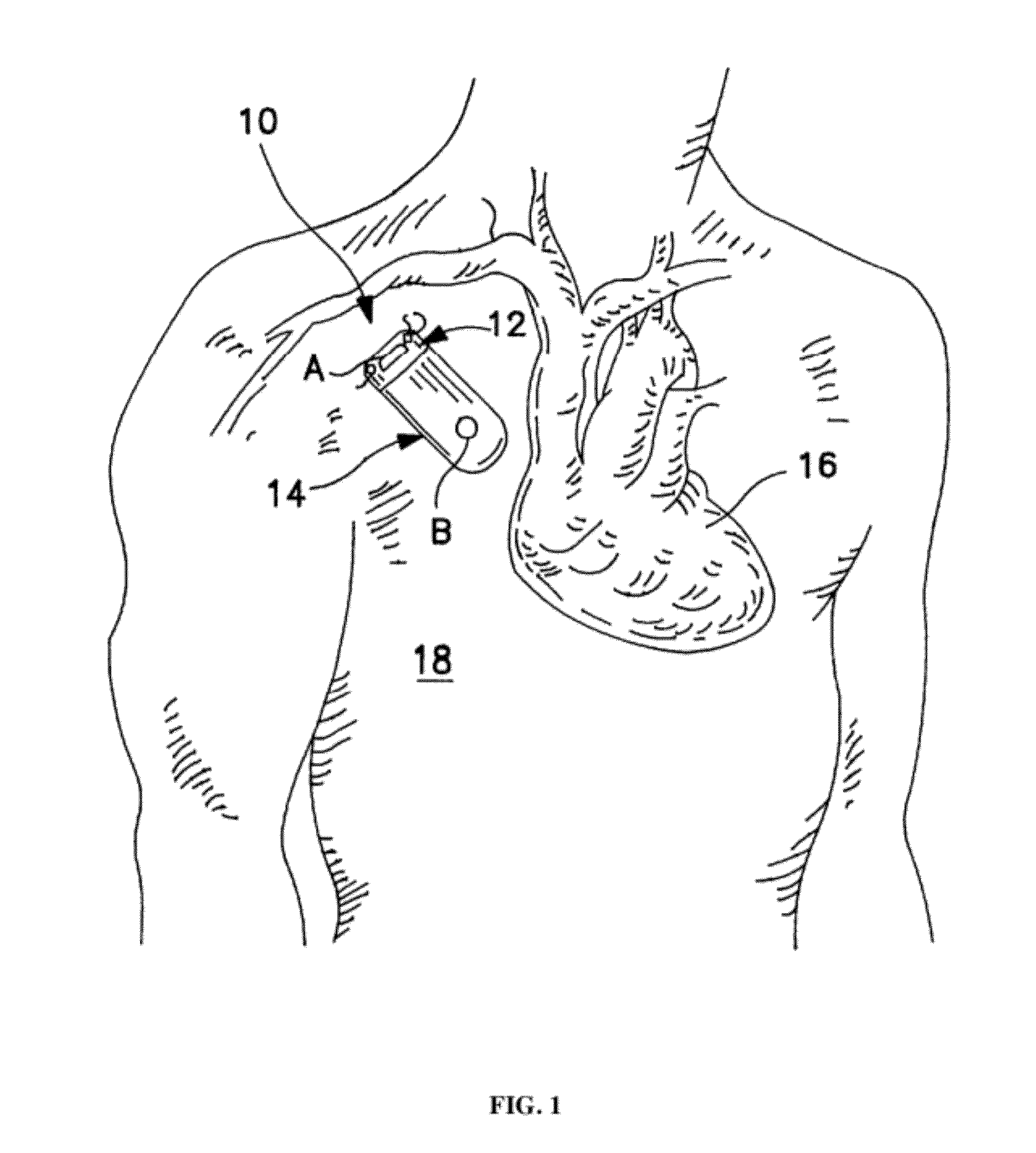 Method and device to monitor patients with kidney disease