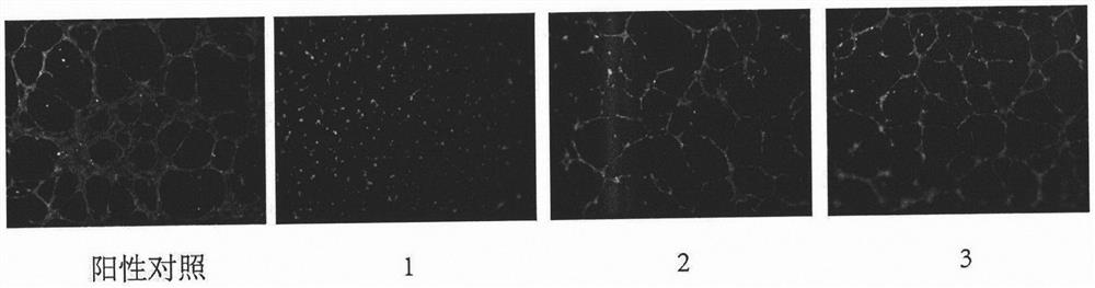 Tripterone 3-site modified derivative and application in preparation of antitumor drugs