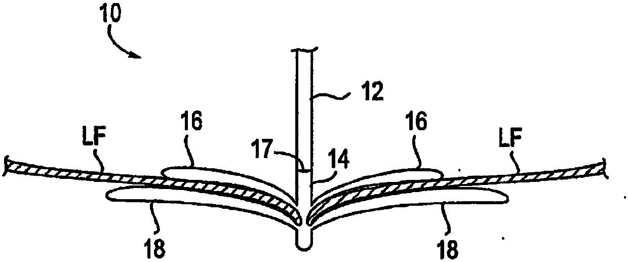 Improved tissue fixation devices