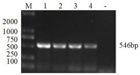 Fourfold RT-PCR detection primer and reagent kit of four porcine epidemic diarrheaviruses