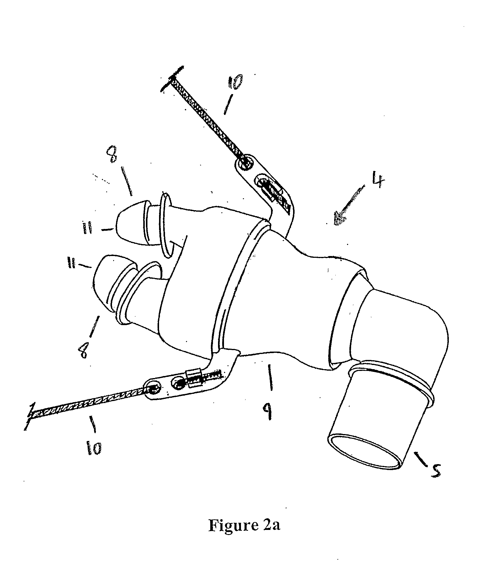Nasal pillows with high volume bypass flow and method of using same