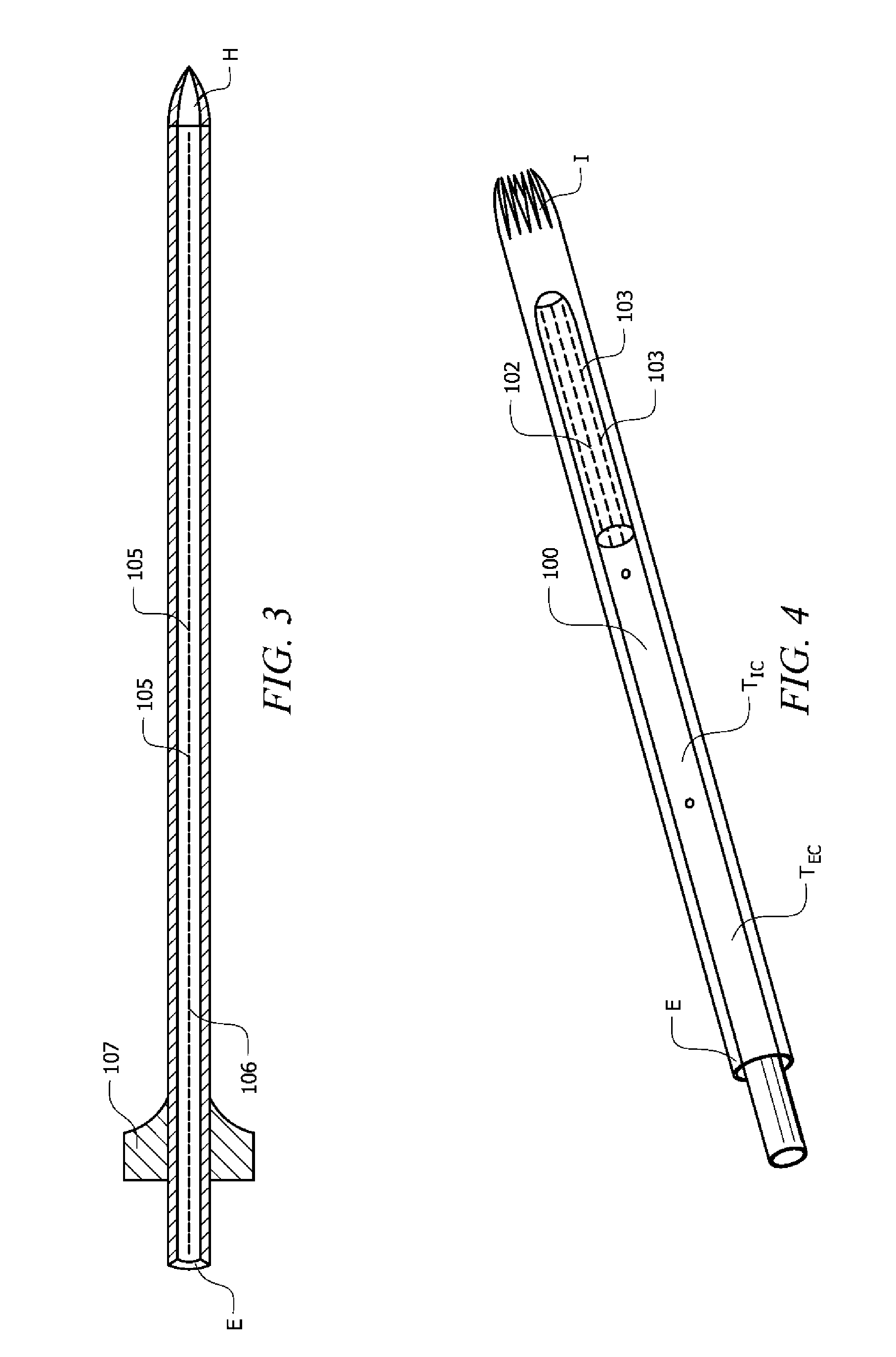 Anti-clogging ventricular catheter for cerebrospinal fluid drainage