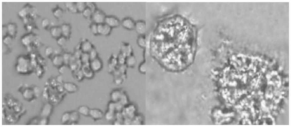 Liver cancer model cell, in-vitro culture method, application and liver cancer animal model establishment method