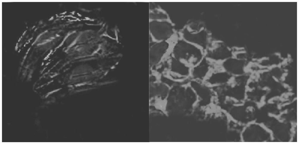 Liver cancer model cell, in-vitro culture method, application and liver cancer animal model establishment method