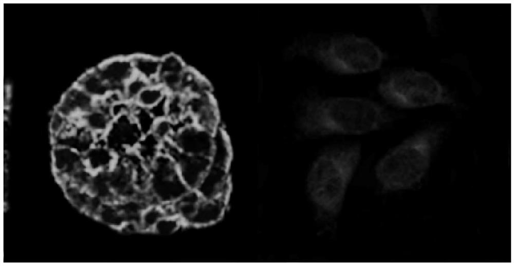 Liver cancer model cell, in-vitro culture method, application and liver cancer animal model establishment method