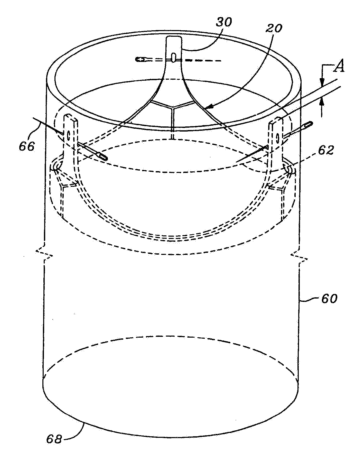 Methods of implant of a heart valve with a convertible sewing ring