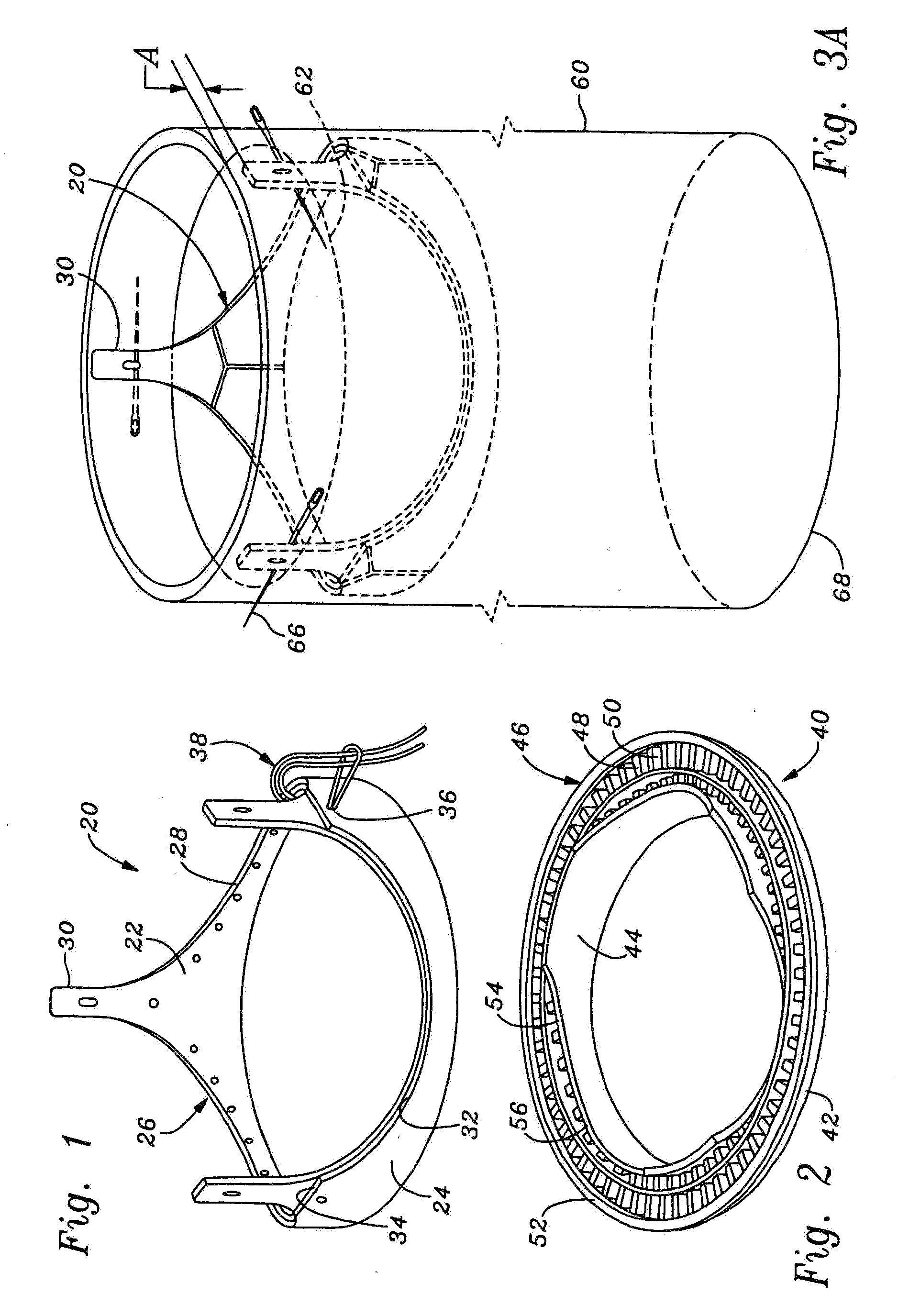 Methods of implant of a heart valve with a convertible sewing ring