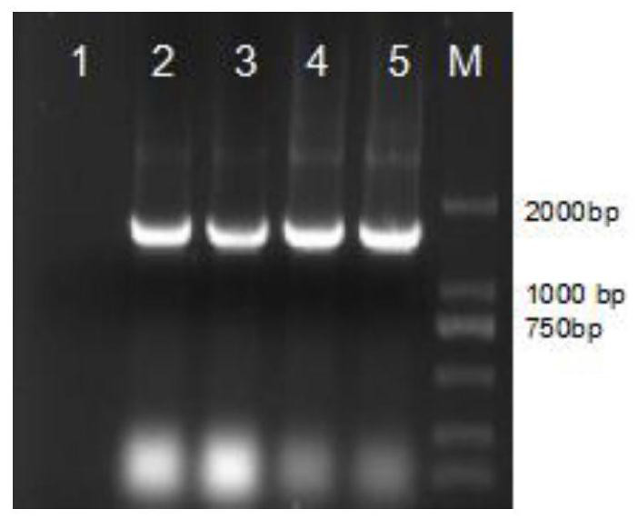 Method for controlling pathogen of candidatus liberibacter in seedlings through composite microorganism treatment and application