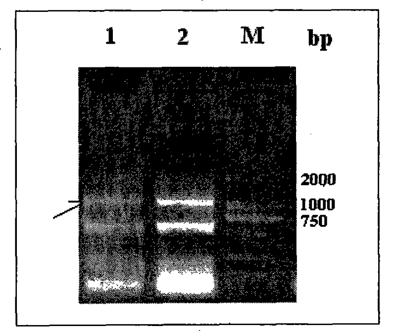 Anthropogenic antivirulin glycosidoprotein neutralizing genetic engineering antibody RD9 and preparation and application thereof