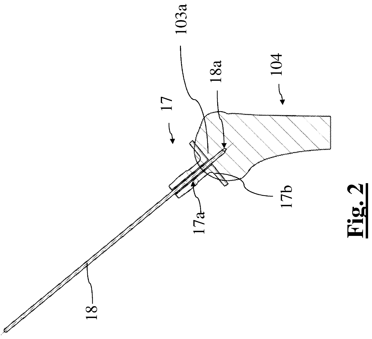 Method for surgical application of a glenoid prosthesis component of a shoulder joint prosthesis and relating surgical instruments