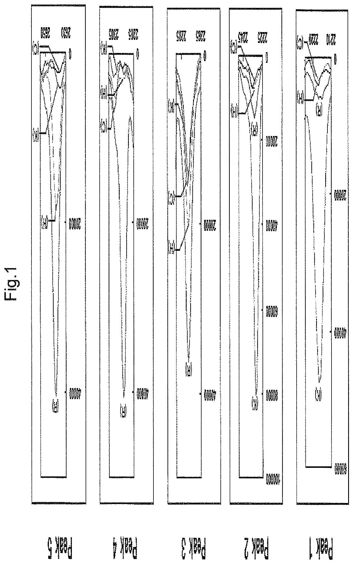 Periodontal-disease-specific peptide, and treatment and diagnosis of periodontal disease using same