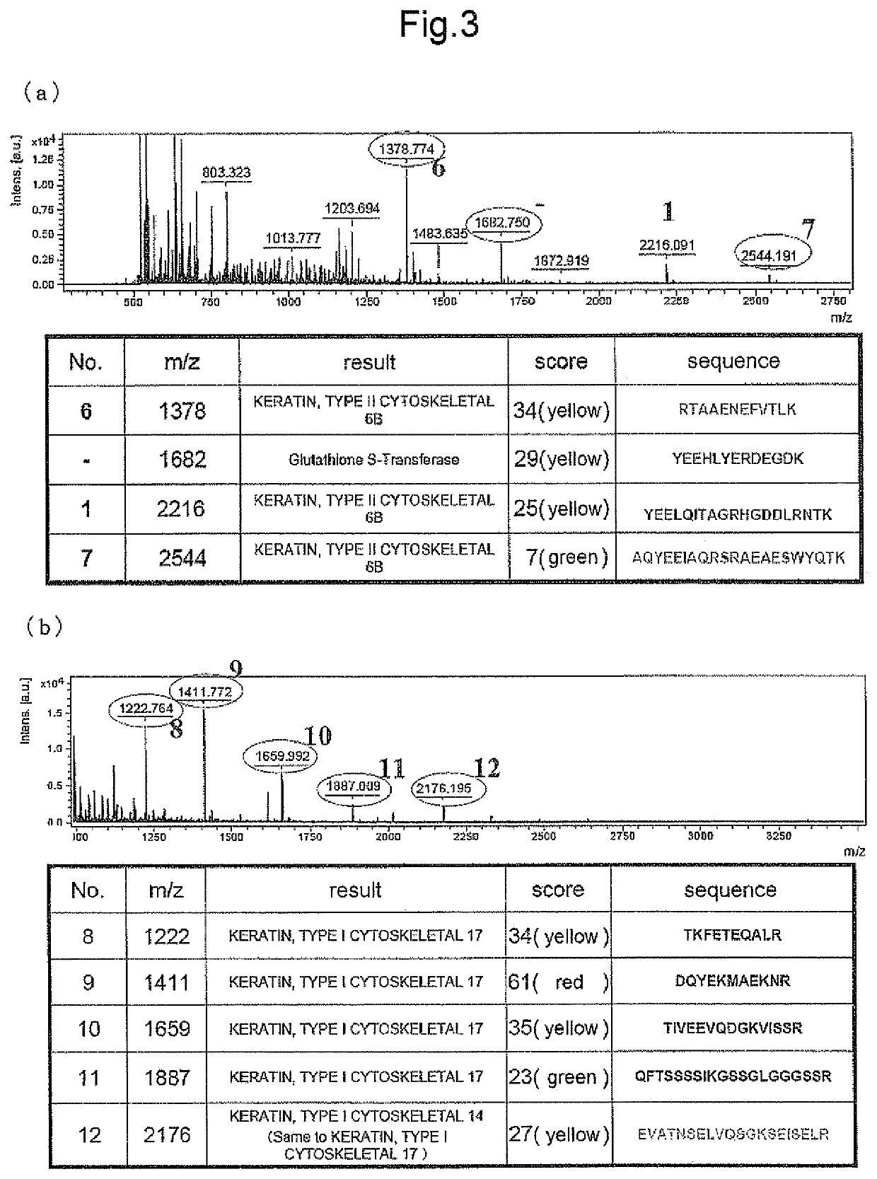 Periodontal-disease-specific peptide, and treatment and diagnosis of periodontal disease using same