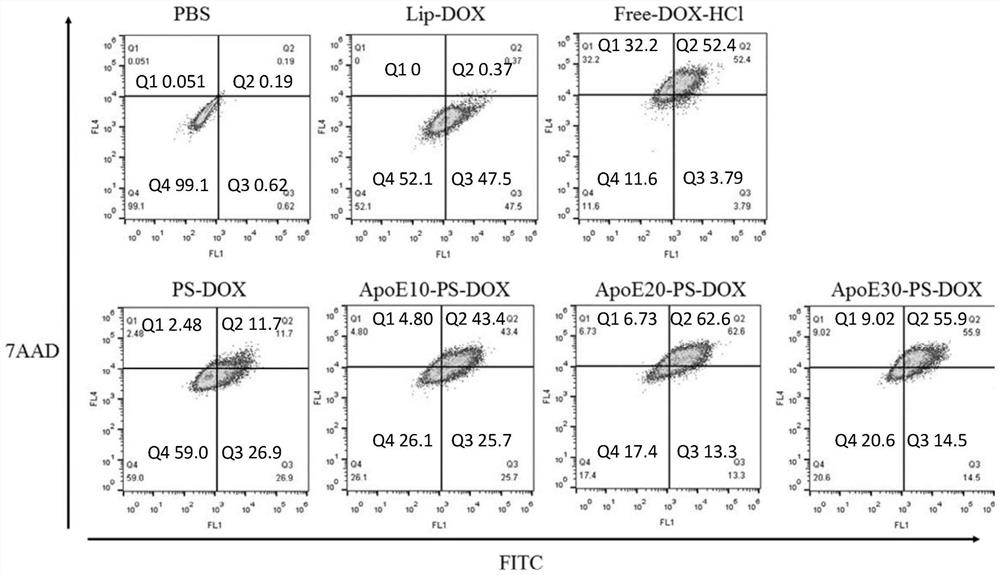 Application of a single-targeted reduction-responsive vesicle nanomedicine in the preparation of brain tumor therapeutic drugs