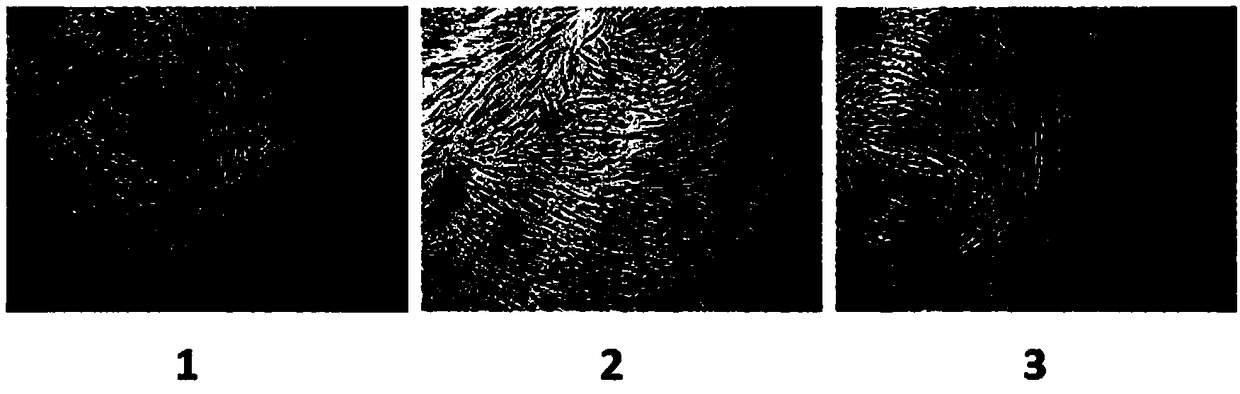 New application of piceatannol in preventing and treating human cytomegalovirus infection