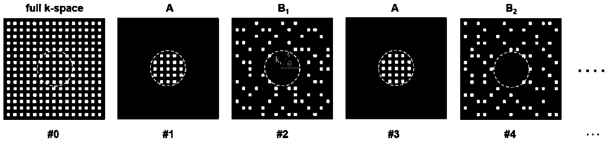 Dynamic Contrast Enhanced Magnetic Resonance Fast Imaging Method Based on Neighborhood Shared Compressed Sensing