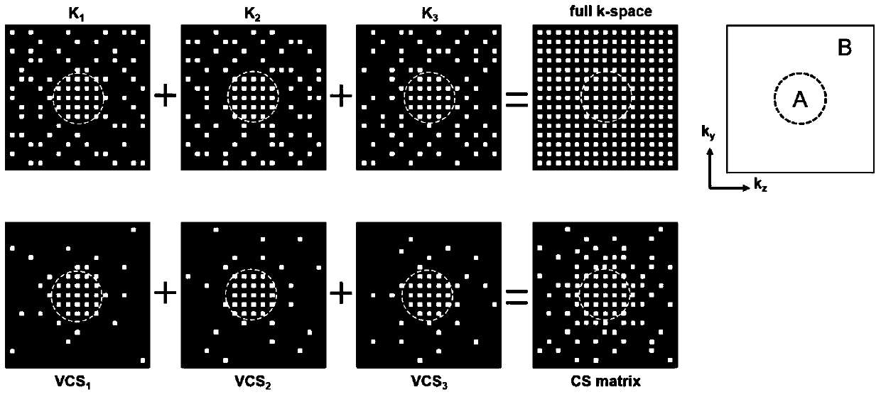 Dynamic Contrast Enhanced Magnetic Resonance Fast Imaging Method Based on Neighborhood Shared Compressed Sensing