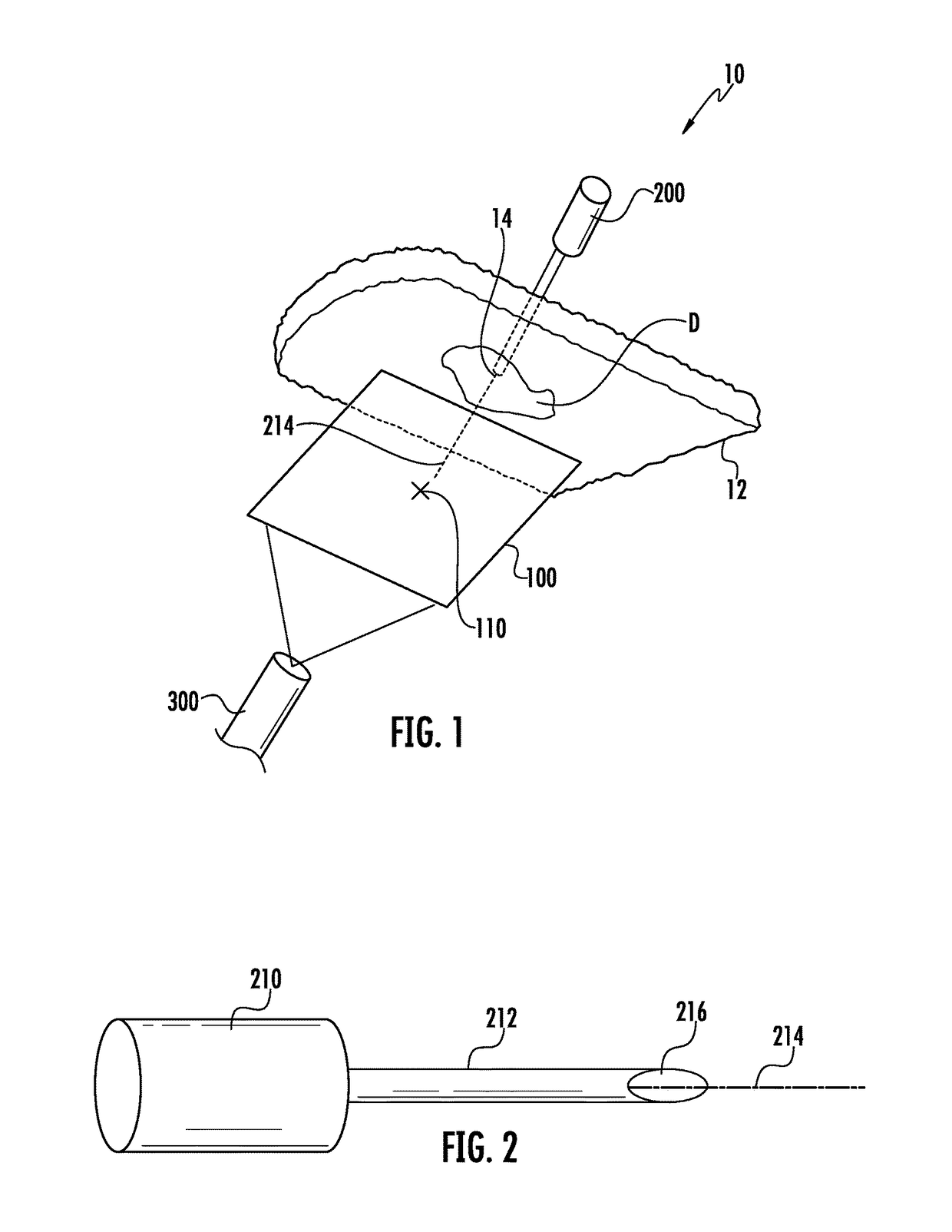 Hernia mesh placement system and method for in-situ surgical applications