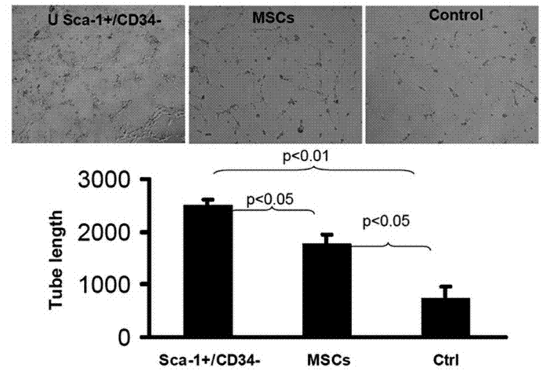 Sca-1+/CD34- uterine stem cells and separation method thereof