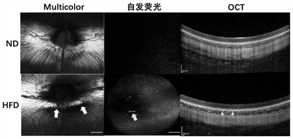 Construction method of high-fat diet induced anterior ischemic optic neuropathy pigment rabbit model and application