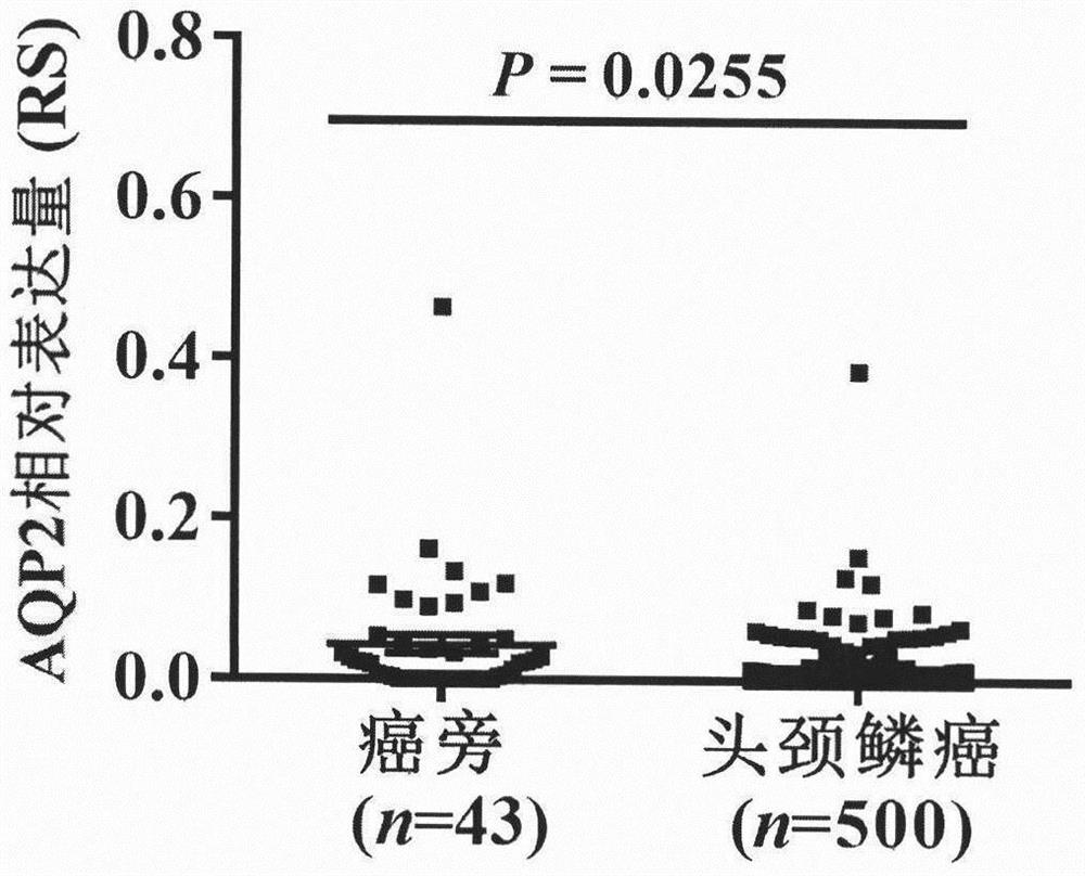 Tumor marker AQUAPORIN2 protein and application thereof