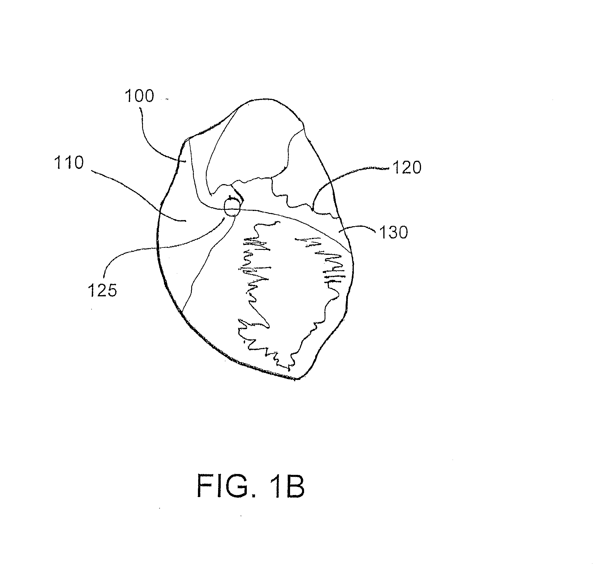 Systems and methods for localization of a puncture site relative to a mammalian tissue of interest