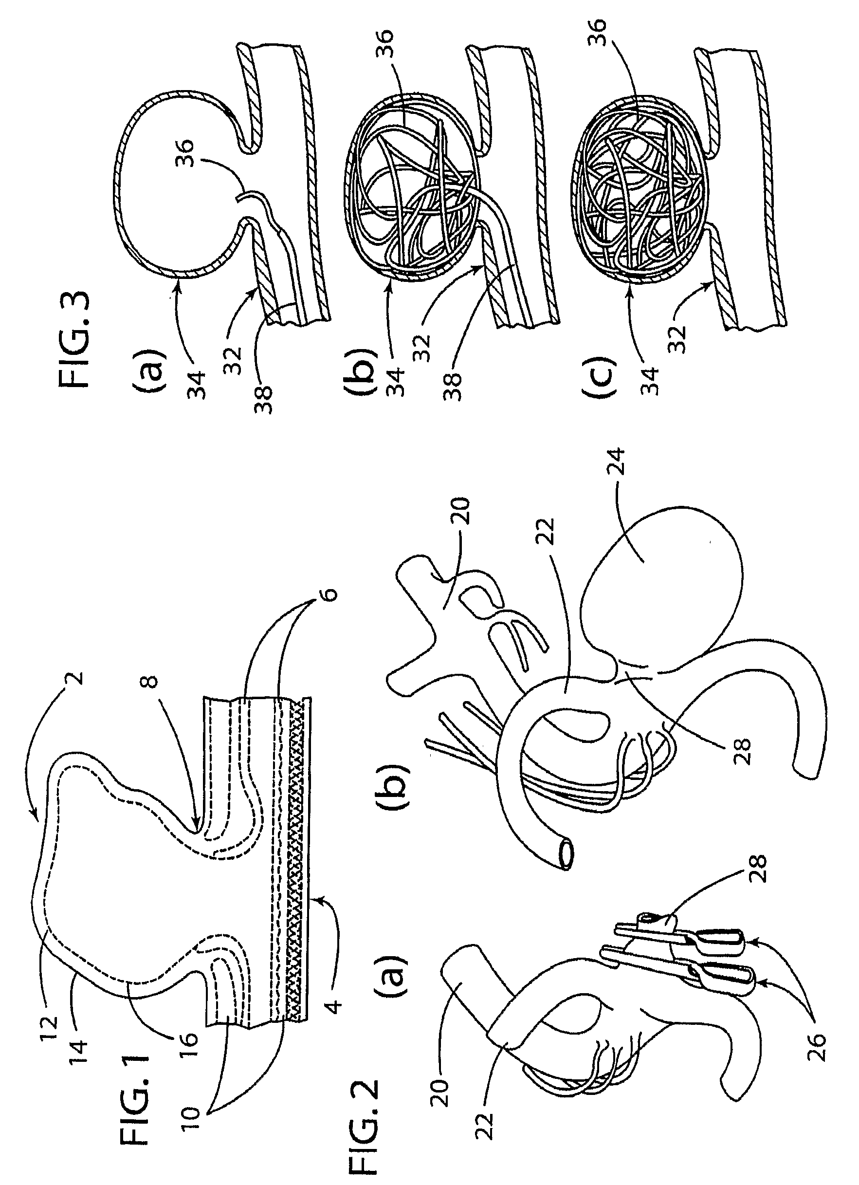 Method for non-invasive detection and treatment of cerebral aneurysms