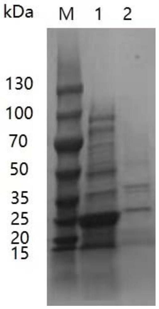 Recombinant expression vector, genetically engineered bacterium, and culture method and application of genetically engineered bacterium