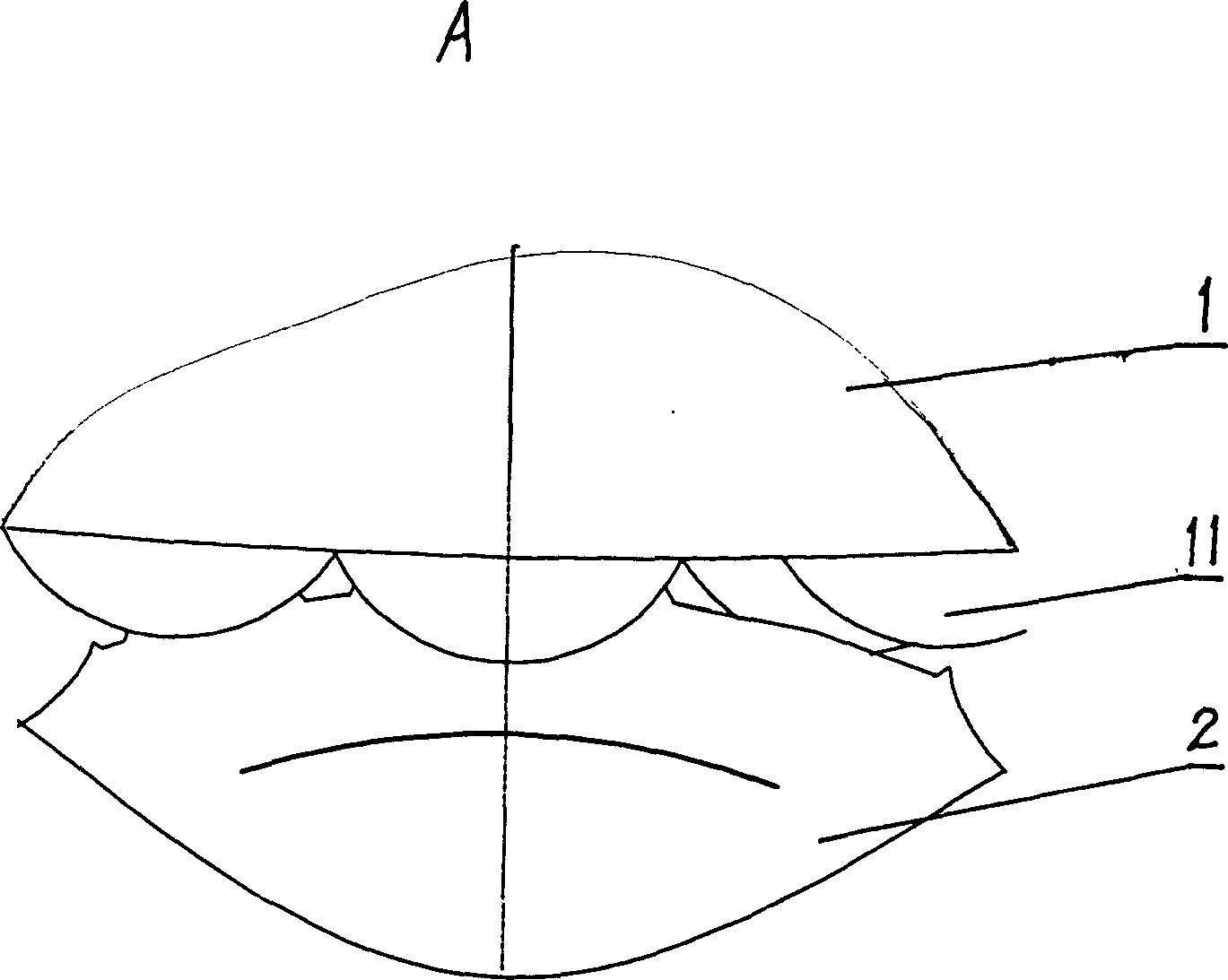 Rolling press treating method for surface protruding on metal material