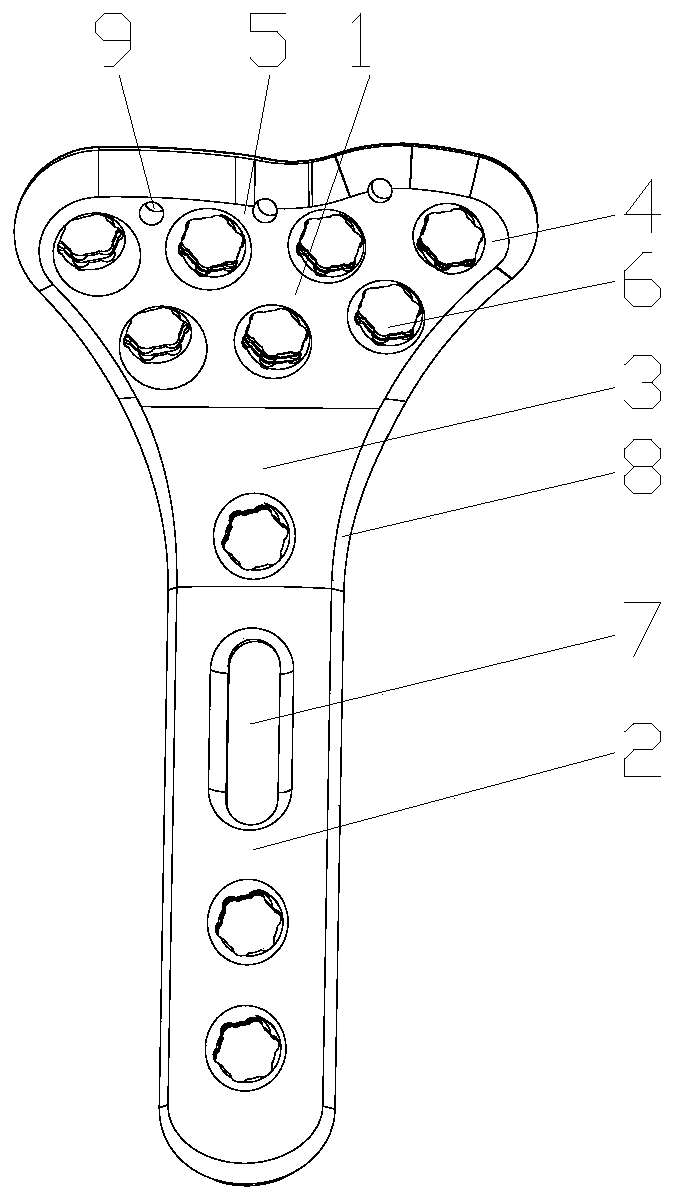 Universal bone fracture plate for radius