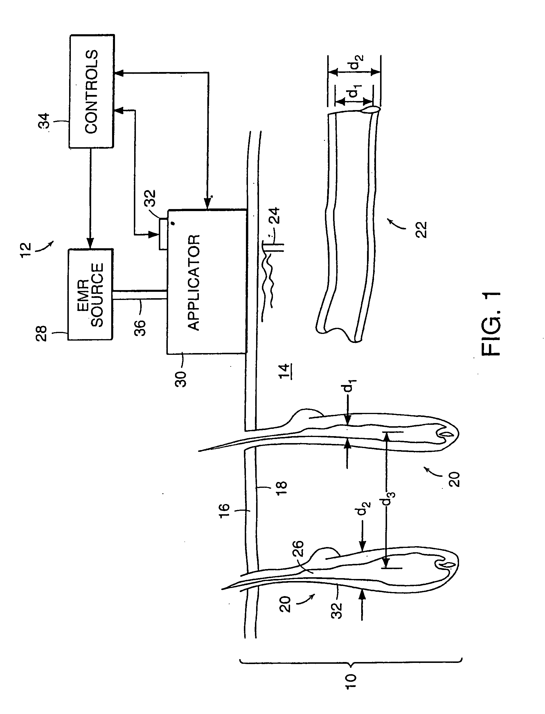 Method and apparatus for medical treatment utilizing long duration electromagnetic radiation