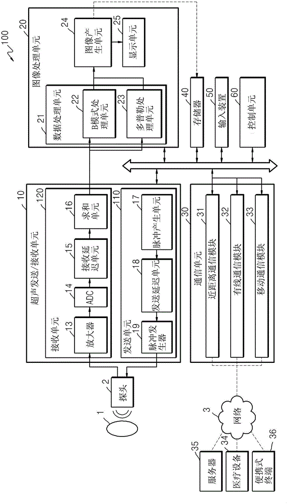 Ultrasound diagnosis apparatus and time gain compensation (TGC) setting method performed by the ultrasound diagnosis apparatus