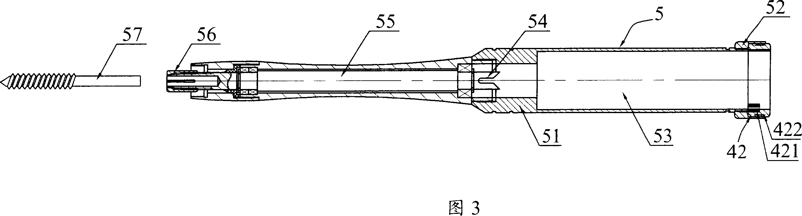 Multifunctional orthopedic operation equipment and its automatic control method