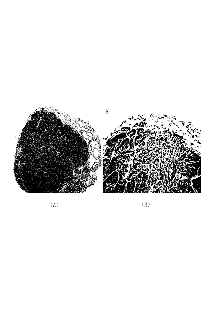 Dietary supplement for preventing lung cancer and preparation method thereof