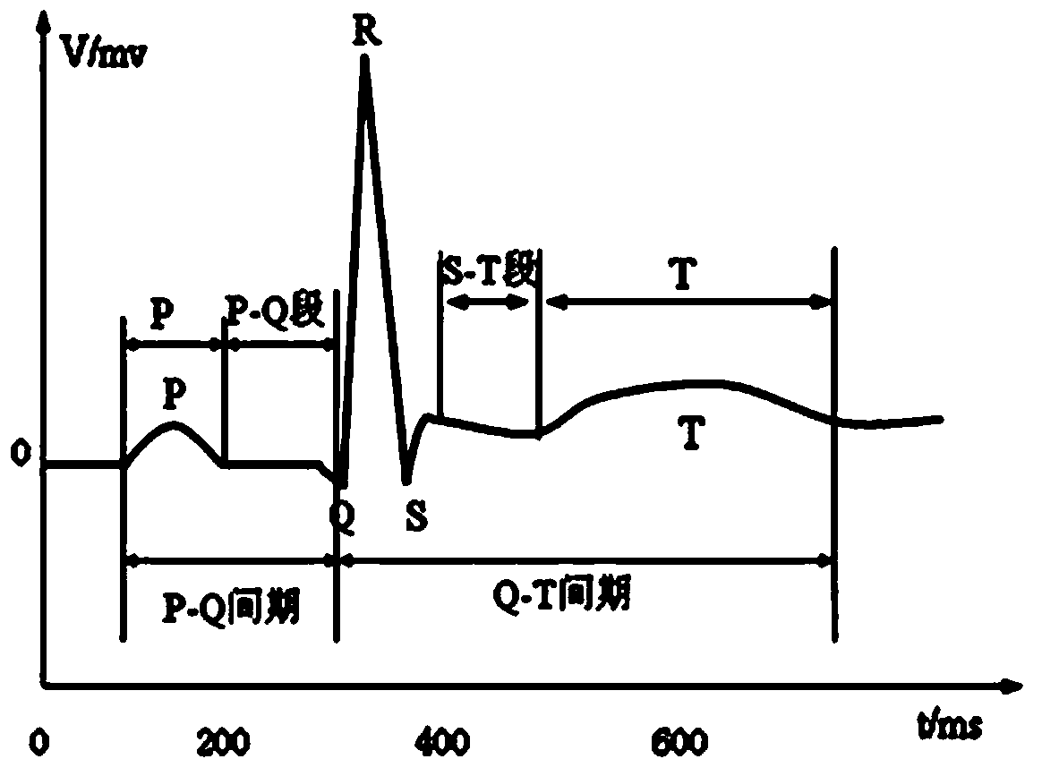 Double-layer morphological filter based electrocardiosignal preprocessing method