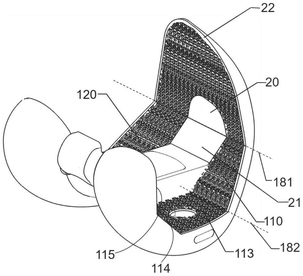 Cobalt alloy partition bone trabecula femoral condyle prosthesis and preparation method