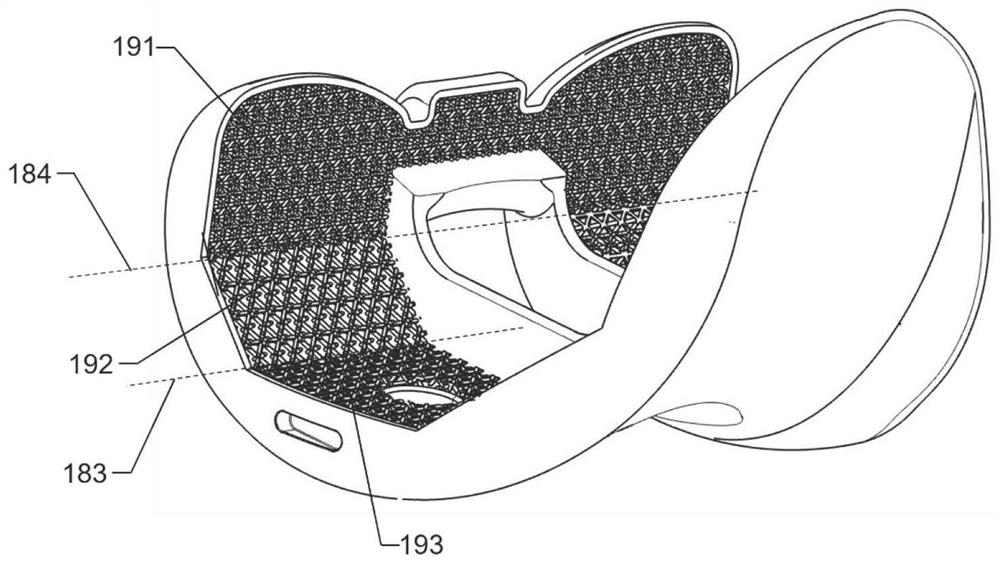 Cobalt alloy partition bone trabecula femoral condyle prosthesis and preparation method