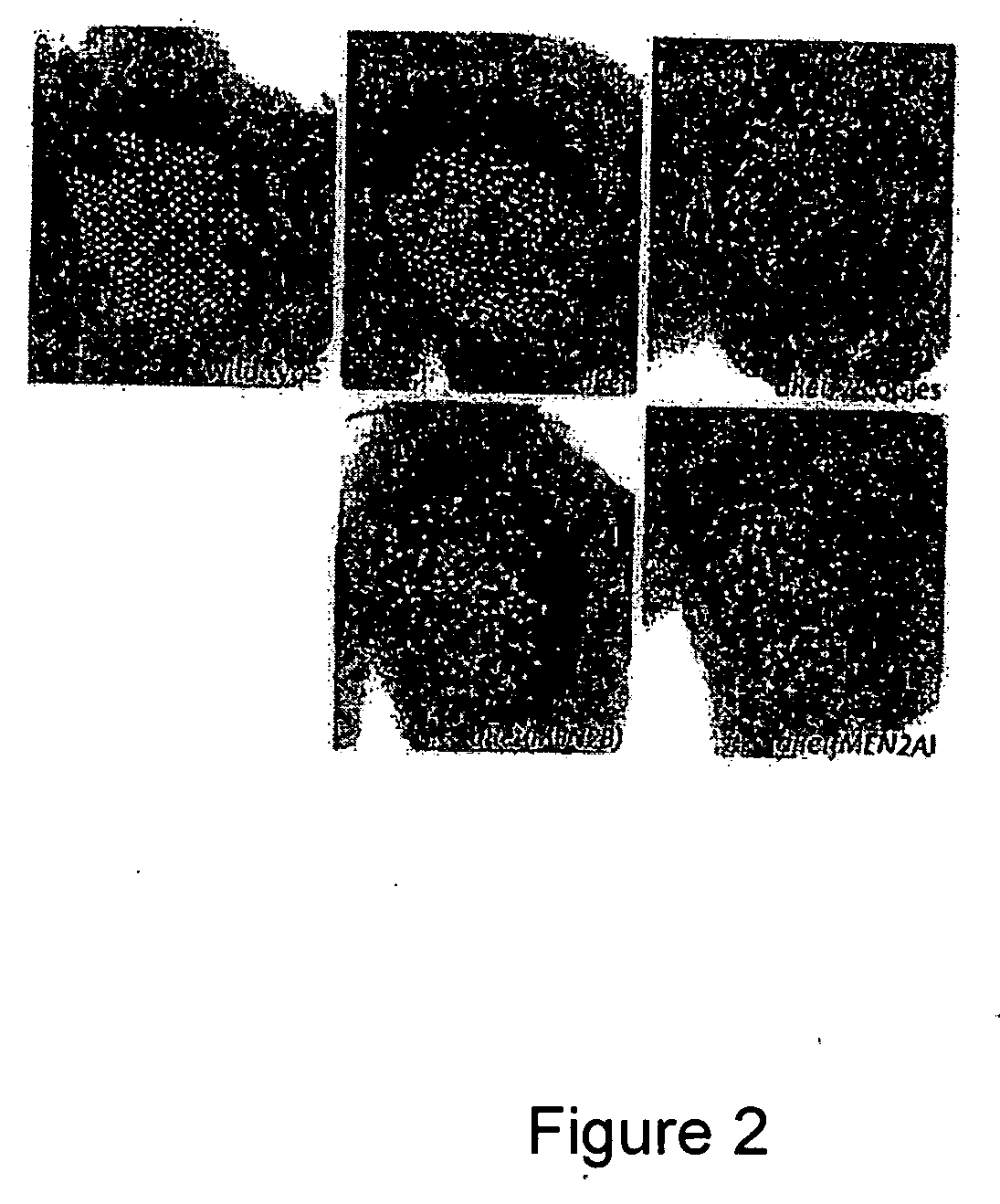 High throughput screening methods for anti-metastatic compounds