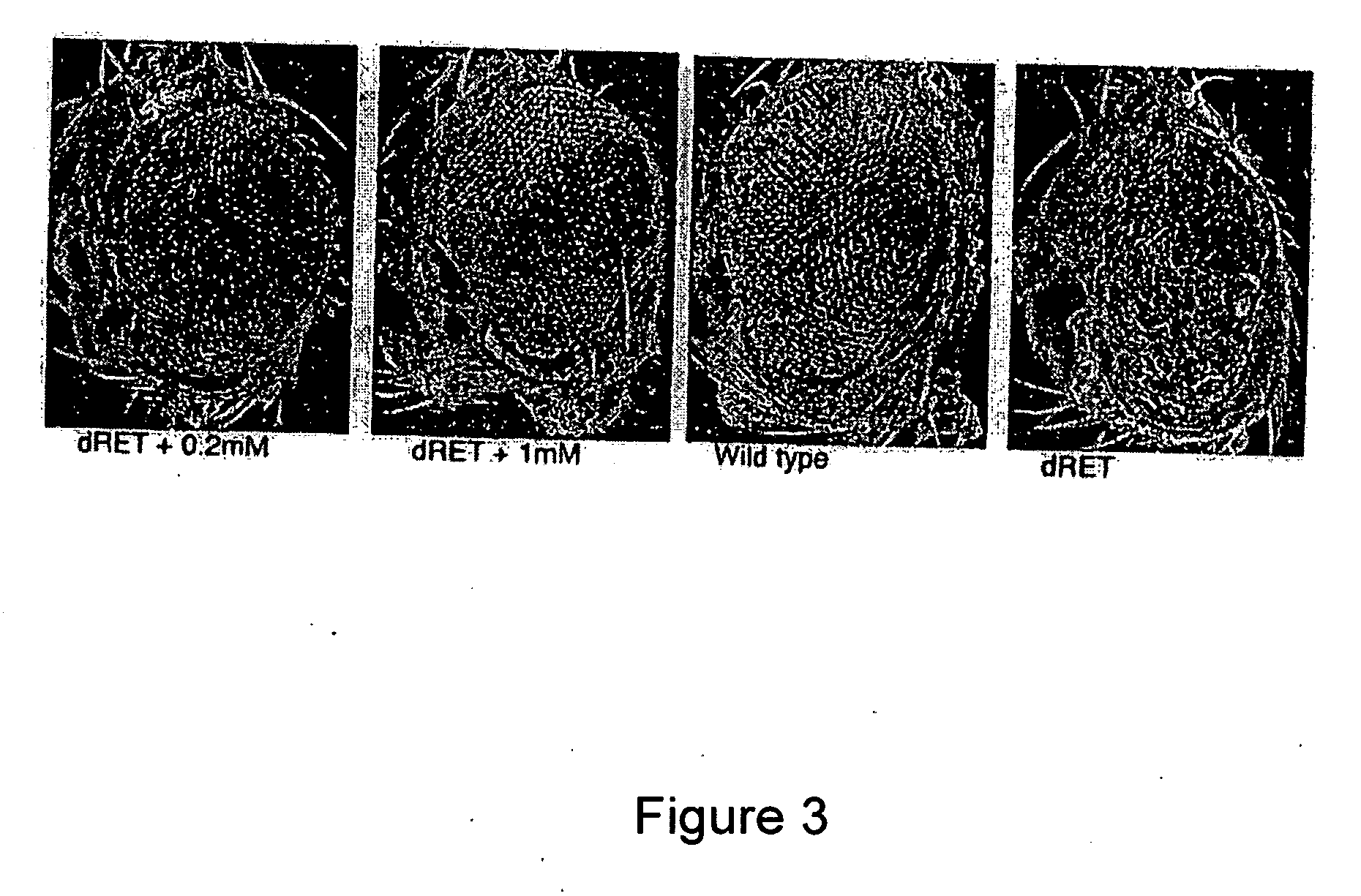 High throughput screening methods for anti-metastatic compounds