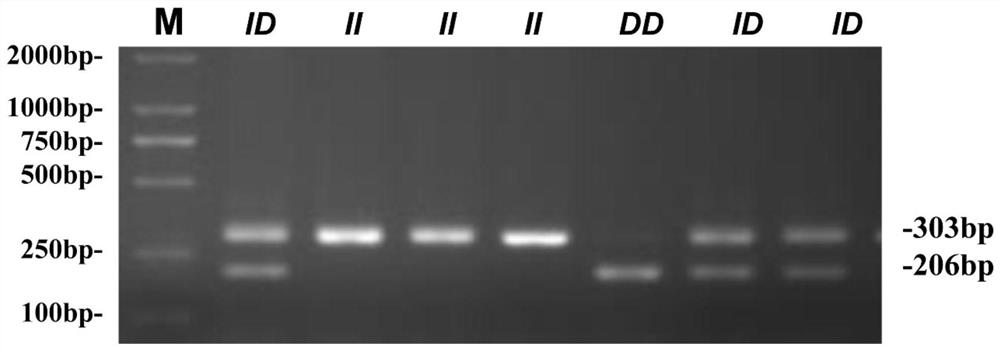 A kind of chicken growth trait gene diagnosis kit and its application
