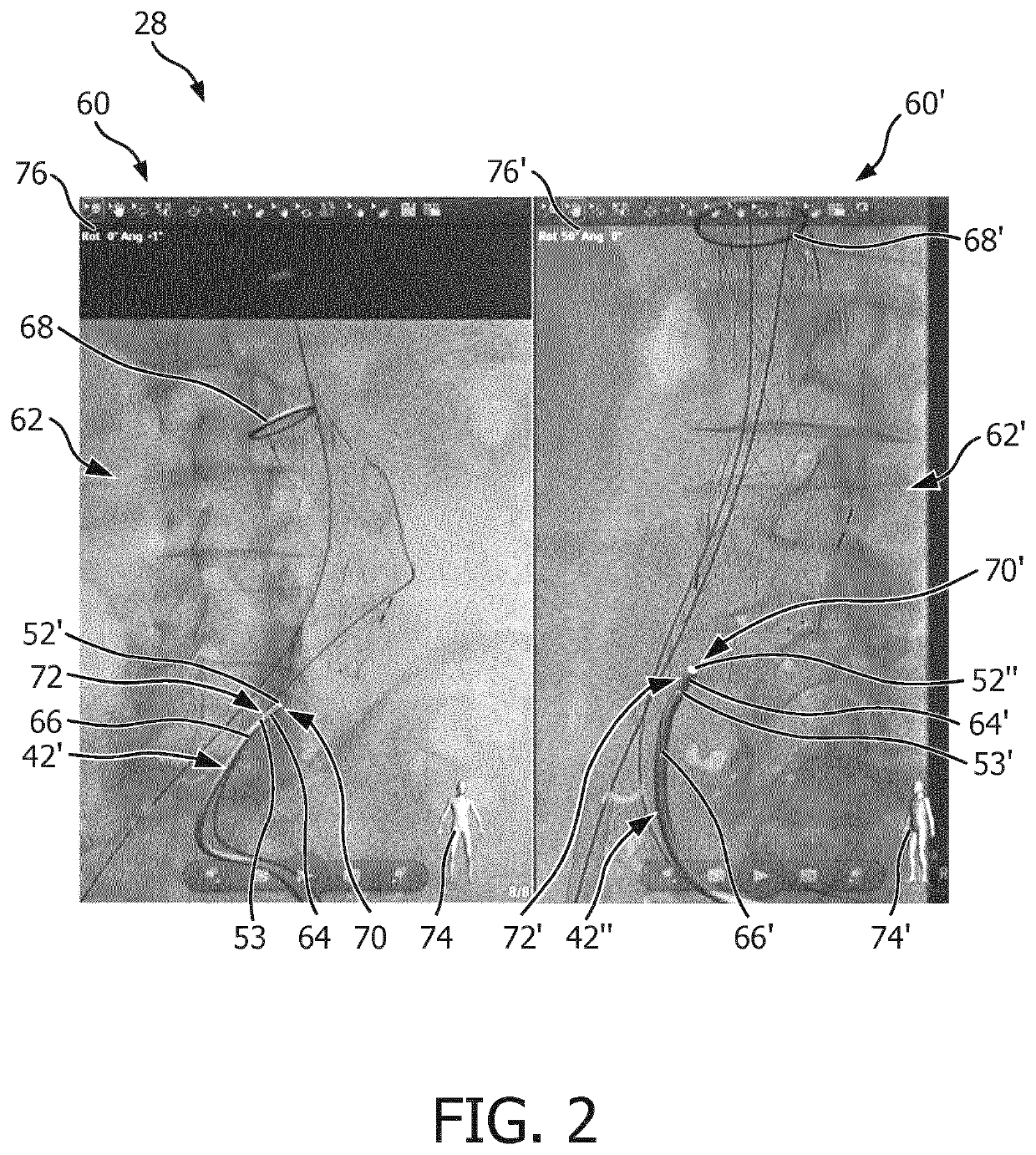 Assisting in moving an insertion element within an object