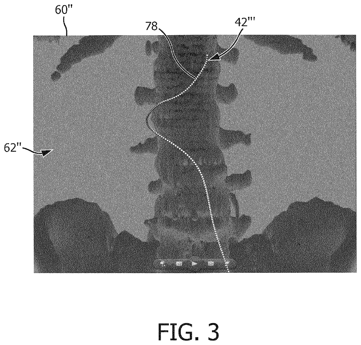 Assisting in moving an insertion element within an object