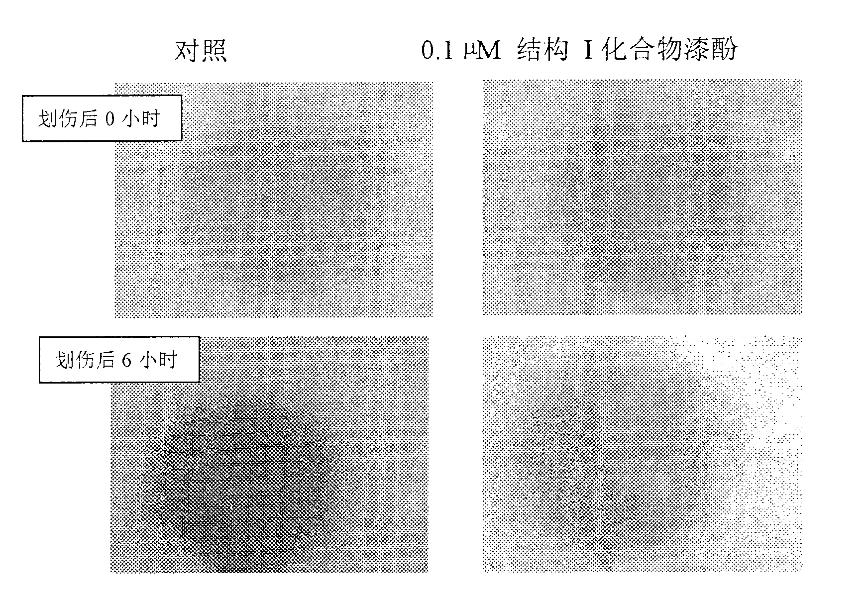 Urushiol compound and medicinal composition thereof, preparation method and application thereof