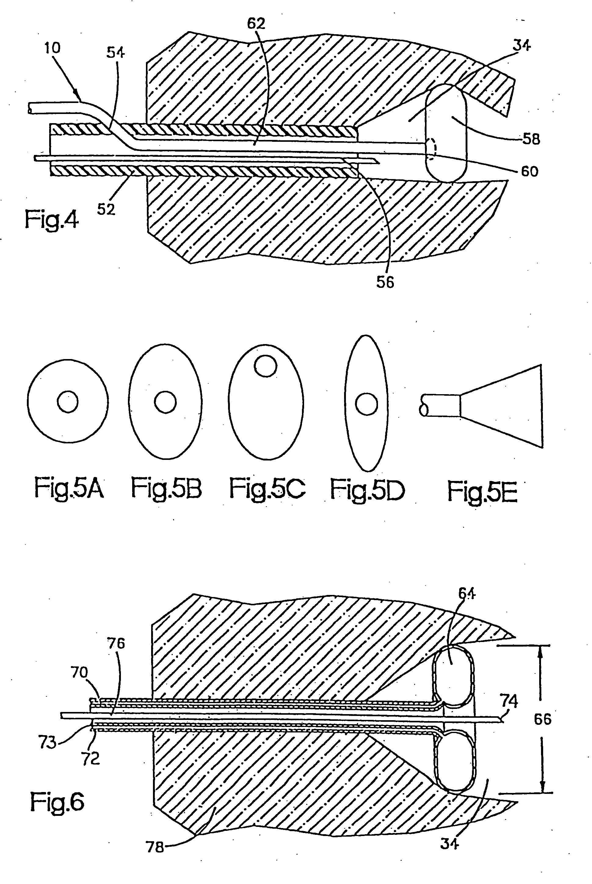 Fluid operated retractors