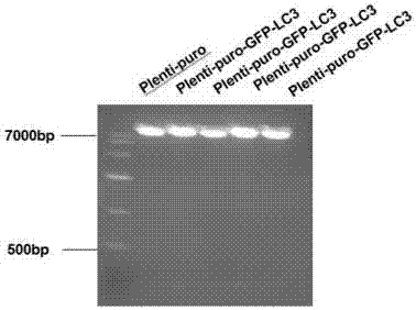 Slow virus green fluorescence autophagy report vector and building method thereof