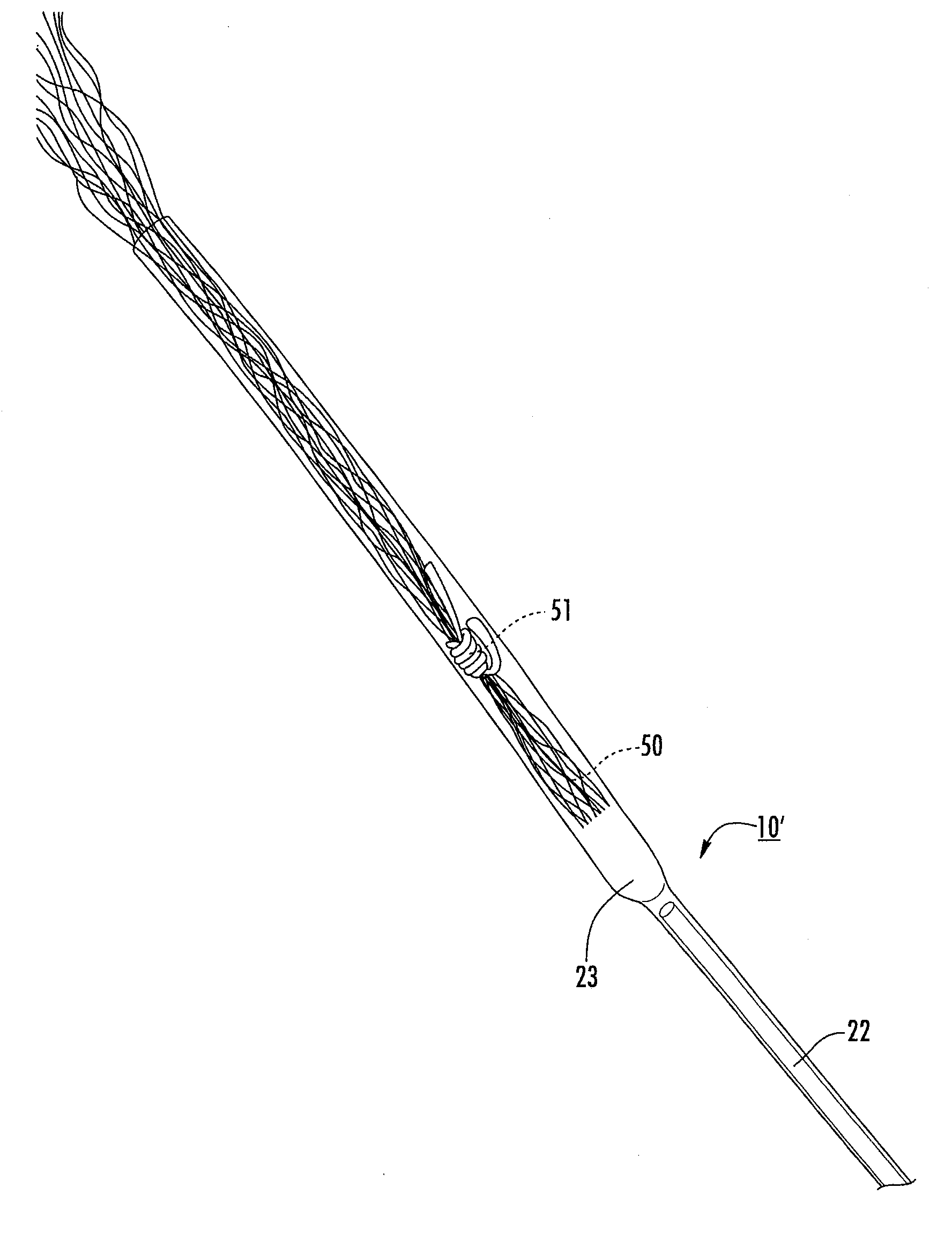 Methods of using compressible tubes for placing implants