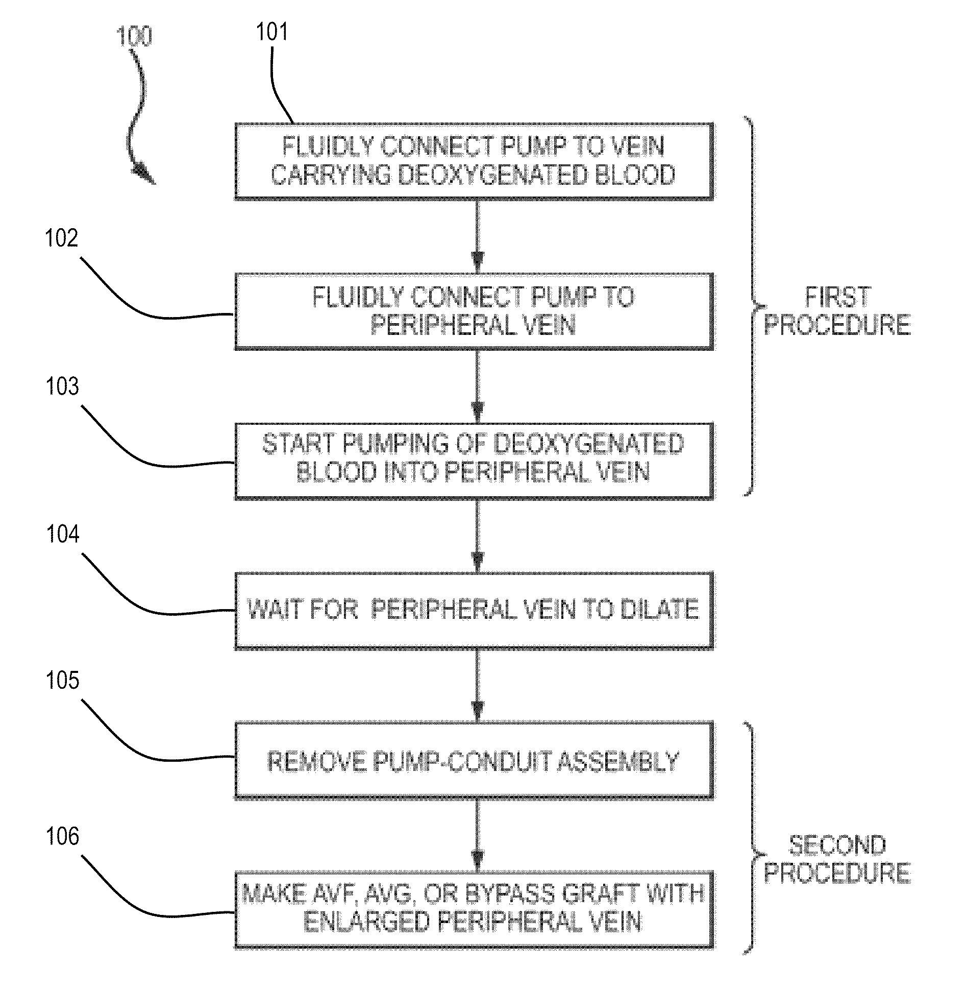 System and method to increase the overall diameter of veins
